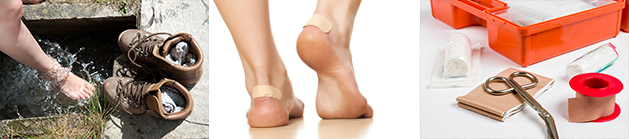 Treating Blisters